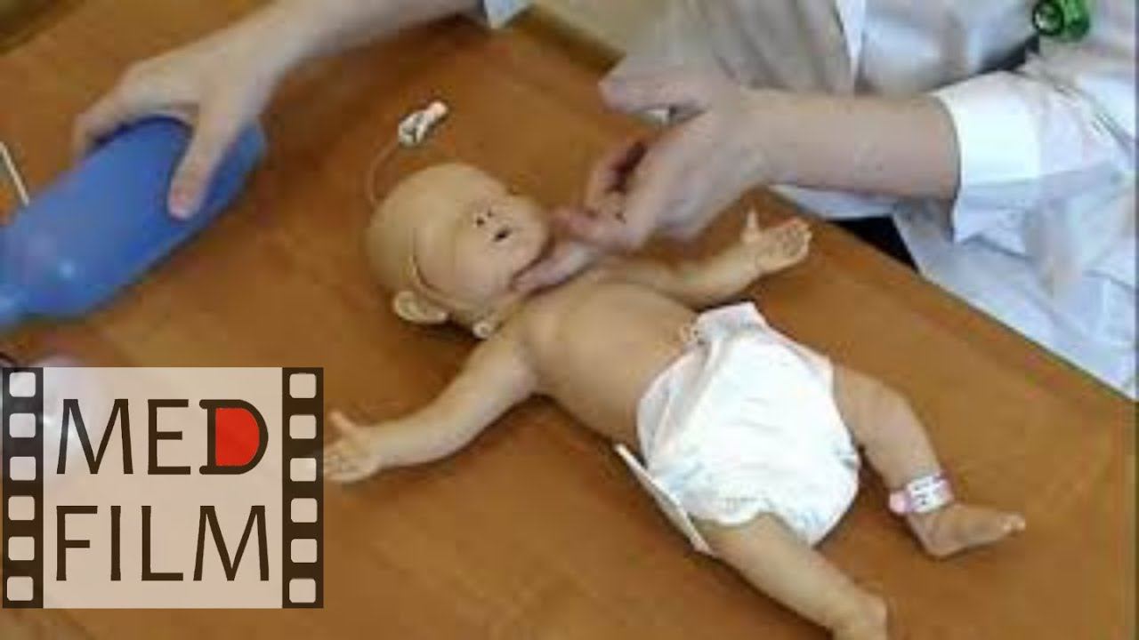 Реанимация новорожденных  © Reanimation Of Newborns