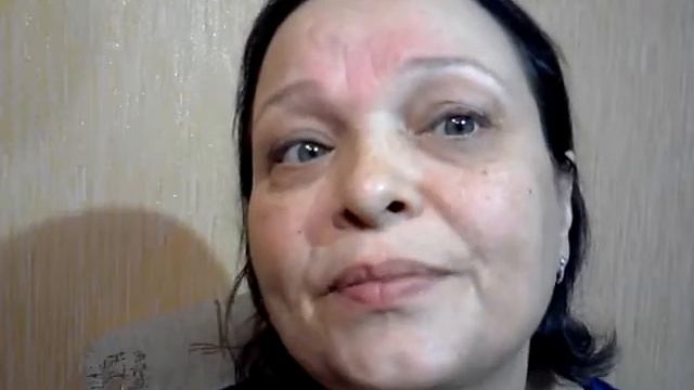 Домашнее омоложение. Дермароллер с титановыми микроиглами смотреть онлайн