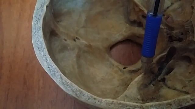 Синусы смотреть онлайн