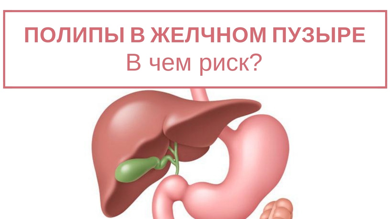Полипы в желчном пузыре. Что делать? смотреть онлайн