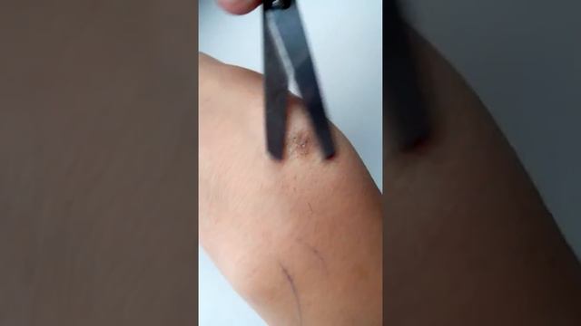 Уроки Парикмахера: как подстригать родинку