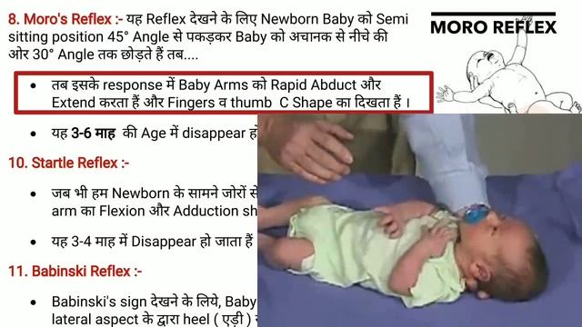Reflexes Of Newborn || Pediatrics