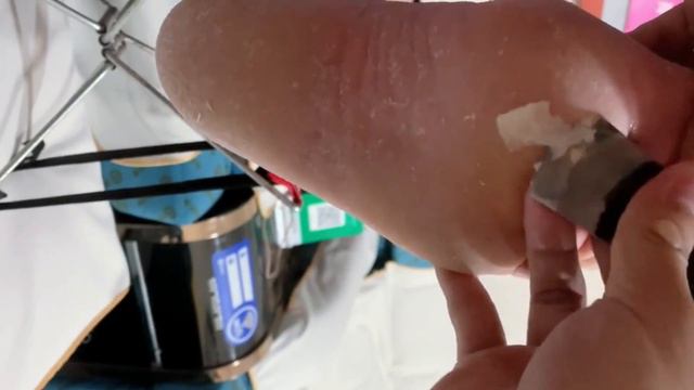 Too serveral calluses on the feet смотреть онлайн
