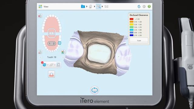 iTero® Scanner Tutorial: Using the Eraser Tool смотреть онлайн