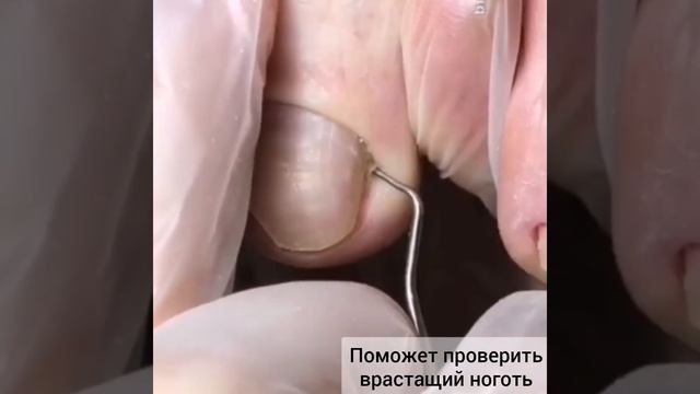 КЮРЕТКА ДЛЯ ПЕДИКЮРА С ПЛОСКИМИ ЛОПАТКАМИ НА КОНЦАХ смотреть онлайн