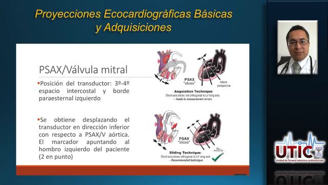 Tema 5 : Proyecciones Ecocardiográficas смотреть онлайн