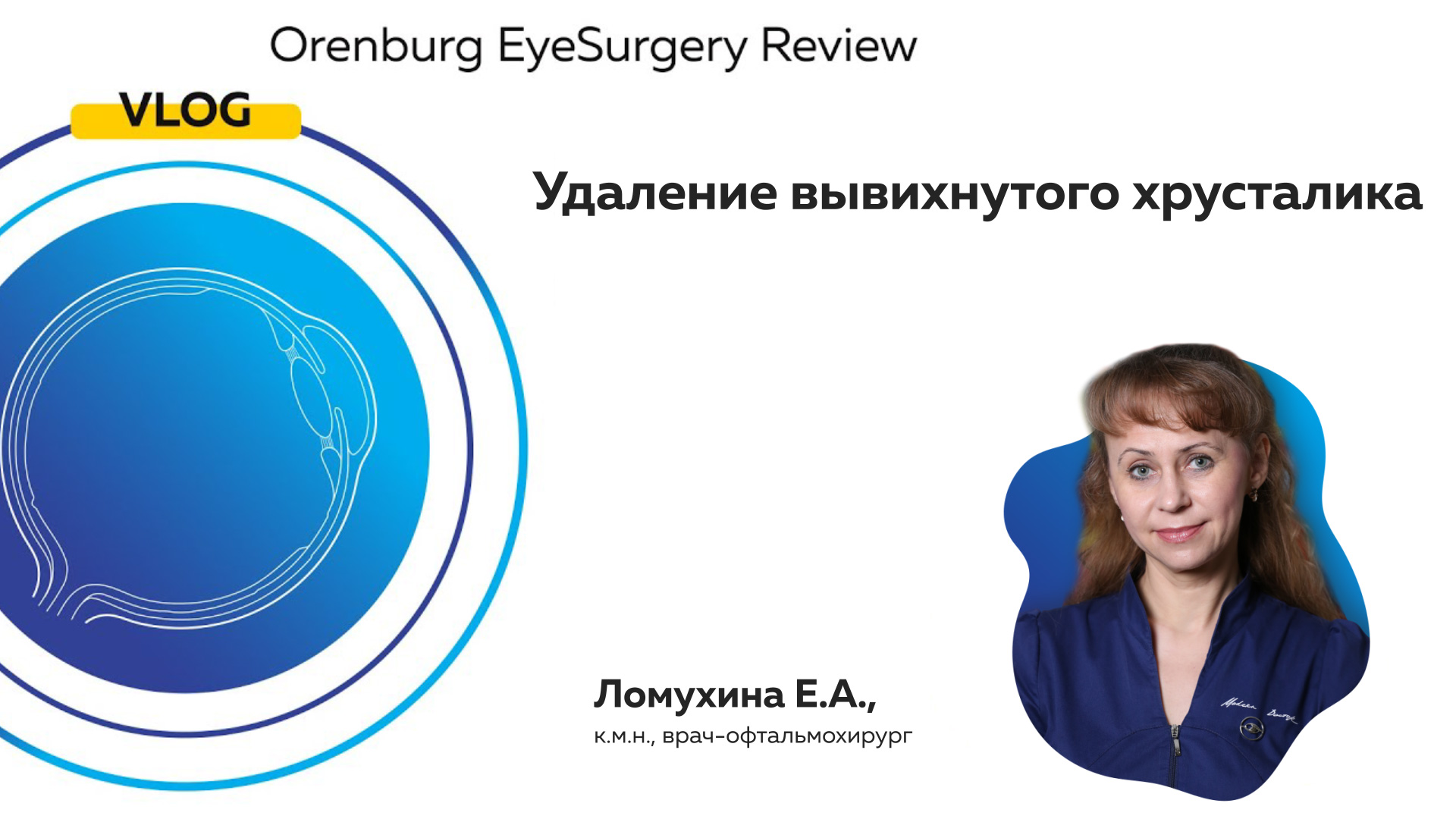 Orenburg EyeSurgery Review