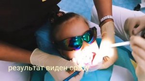 Пластика уздечек лазером.