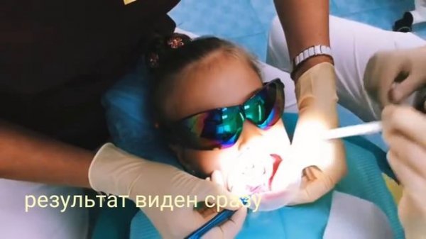 Пластика уздечек лазером.