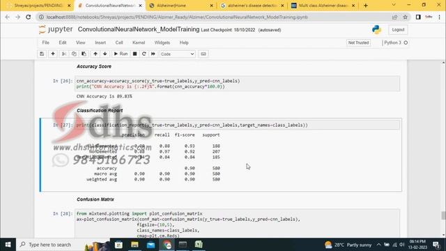 Multi class Alzheimer Detection | Deep Learning | CNN | Python | DHS смотреть онлайн