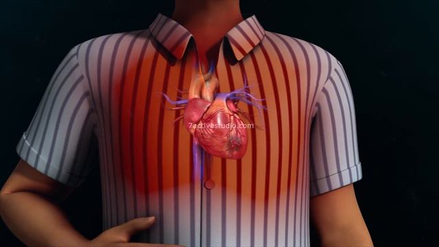 Heart Attack (ACS & MI) | Bengali смотреть онлайн