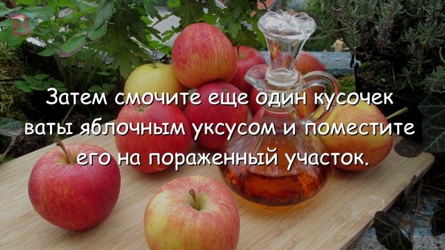 Яблочный Уксус в Деле. Убираем Бородавки. смотреть онлайн