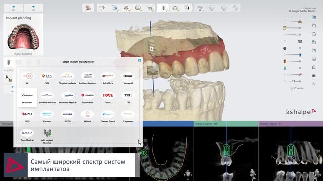3Shape Implant Studio 2019 – Планирование имплантатов и изготовление хирургических шаблонов - A dem смотреть онлайн