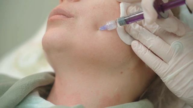 Биоревитализация смотреть онлайн