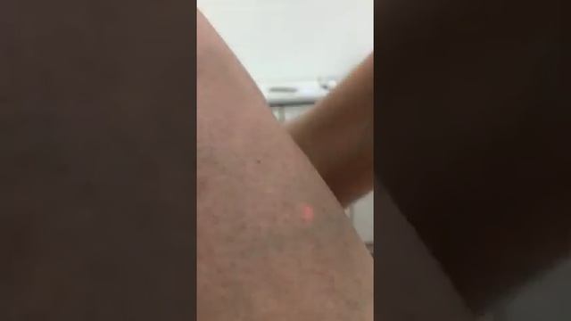 Лазерная эпиляция в Москве - салон Alex Laser смотреть онлайн