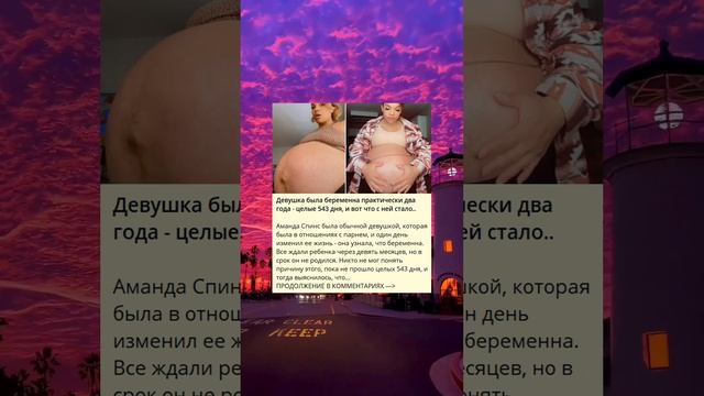 Девушка была беременна практически два года - целые 543 дня, и вот что с ней стало.. смотреть онлайн
