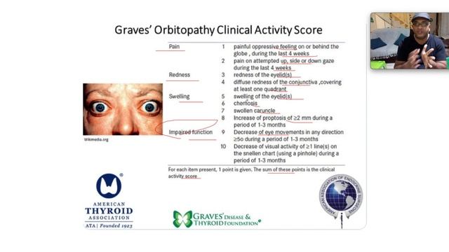 Clinical examination of the thyroid and approach to hyperthyroidism смотреть онлайн