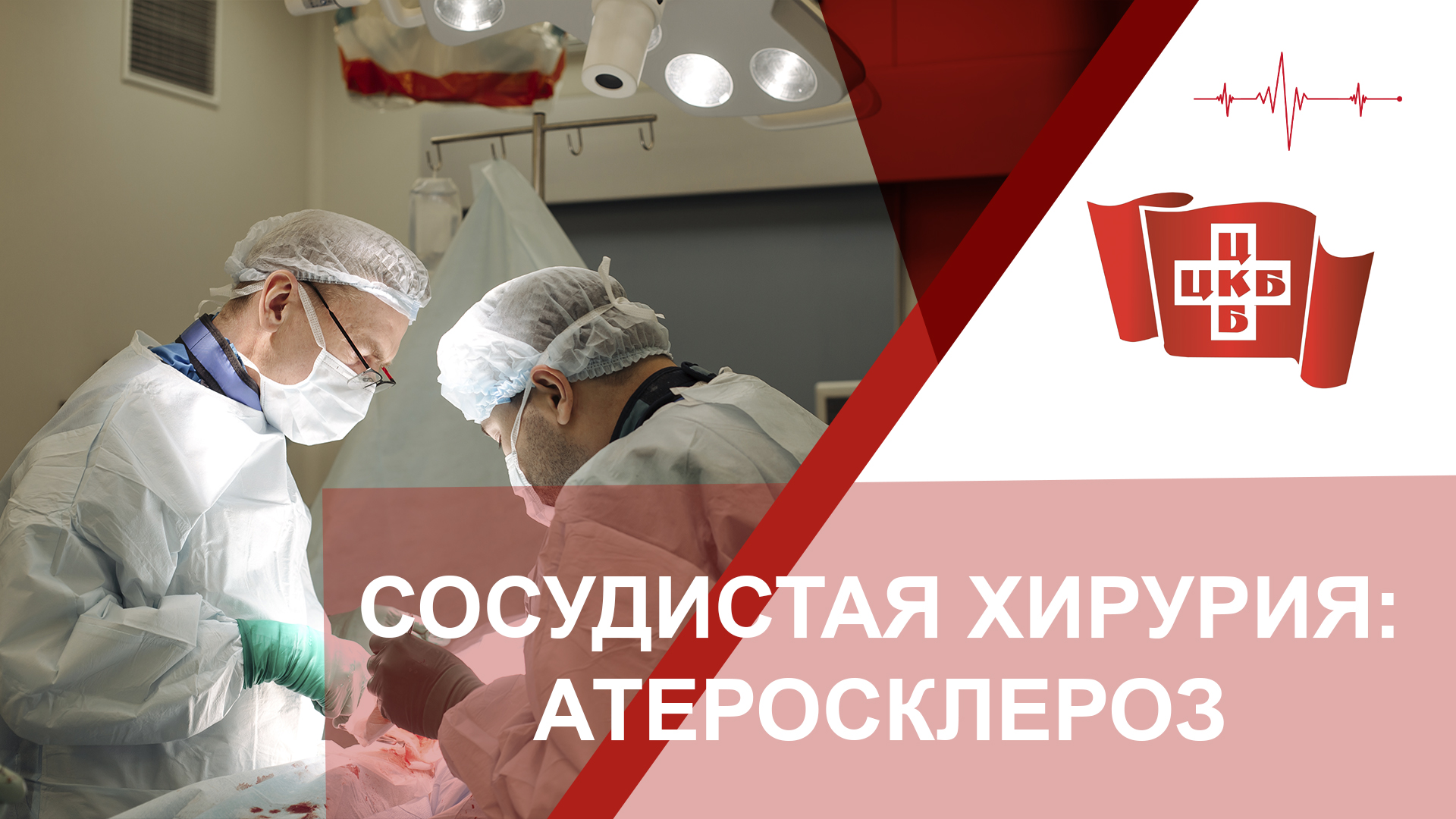 Сосудистая хирургия: операция по артериальной реконструкции при атеросклерозе нижних конечностей