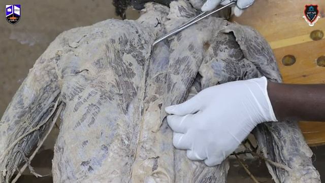 Upper limb I Practical 2 I Female Breast, Shoulder Girdle and Arm (Full Video) смотреть онлайн