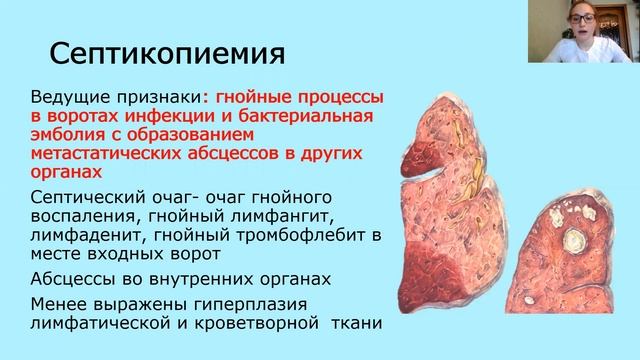 Сепсис. Патологическая анатомия смотреть онлайн