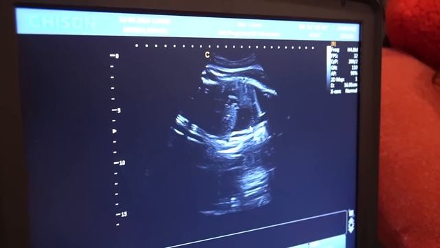 Seeing our Baby’s FACE for First Time! **Emotional** смотреть онлайн
