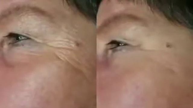 Избавиться от морщин в течение 3 минут. смотреть онлайн