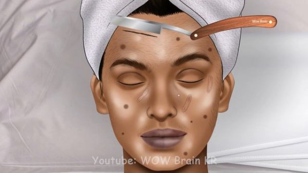 ASMR Help MrBeast Remove Wisdom Teeth | WOW Brain Kr Dental Care Video