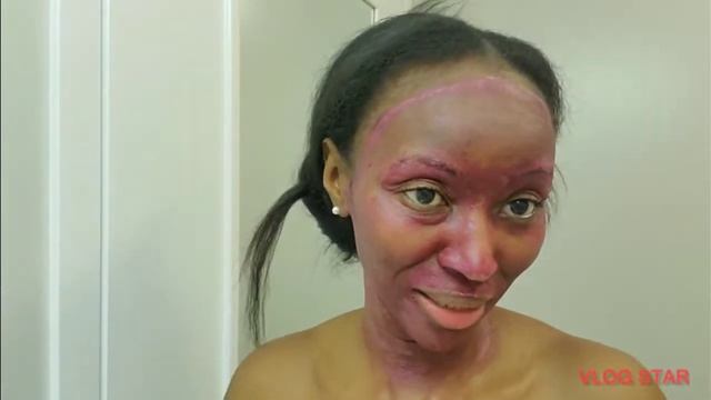 The Ordinary AHA 30% + BHA 2% Peeling Solution