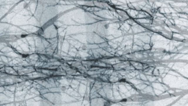 Trentemøller: Take Me Into Your Skin смотреть онлайн