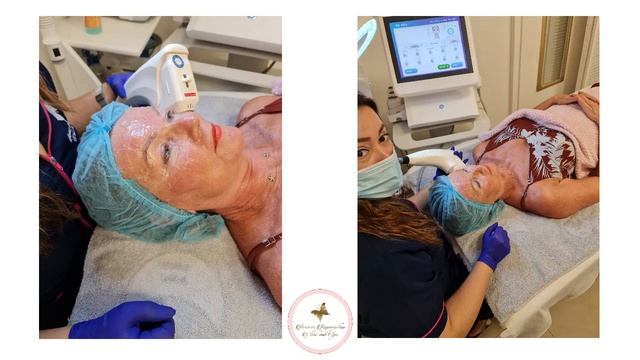 HIFU 4D Es espectacular смотреть онлайн