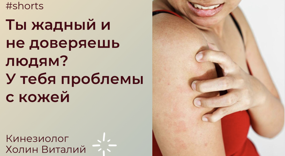 Ты жадный и не доверяешь людям?
У тебя проблемы с кожей смотреть онлайн