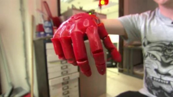 Unit 3_ Robot revolution_ robotic surgery is on the rise