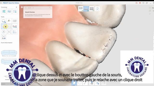 Medit link: Vue d'ensemble de l'aperçu du résultat смотреть онлайн