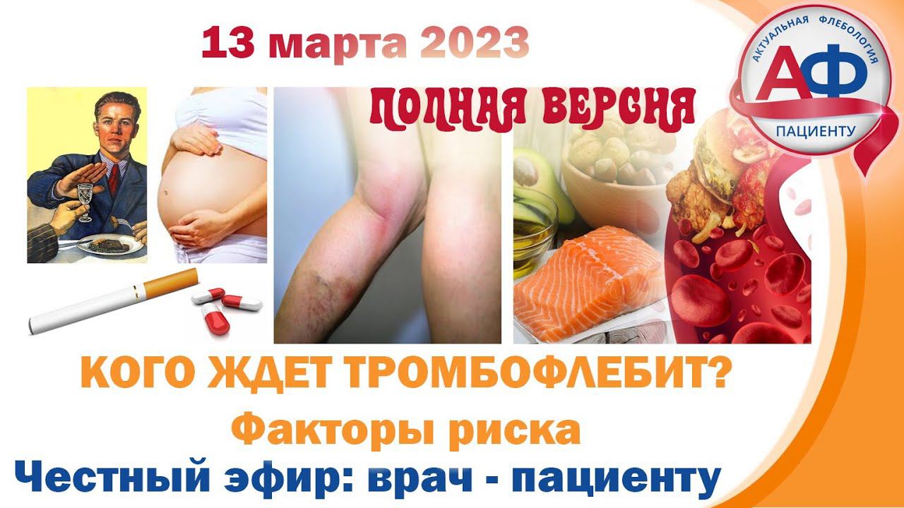 Кого ждет тромбофлебит? Факторы риска смотреть онлайн