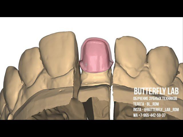 Как смоделировать центральный резец в exocad под редуцирование / нанесение керамики . Основы смотреть онлайн