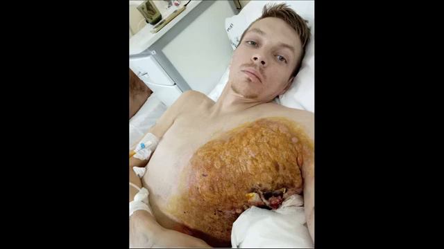 химохим отзыв смотреть онлайн