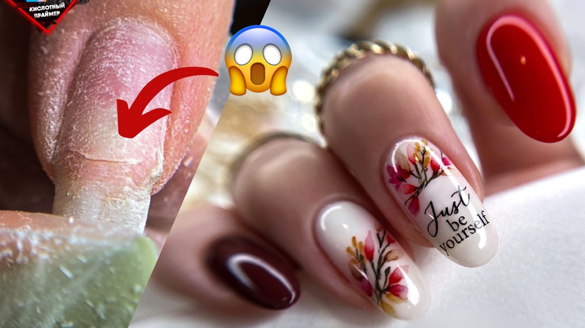 ЖЕСТКИЕ ТРЕЩИНЫ до МЯСА! ТЕСТИРУЕМ ГЕЛИ с Wildberries ANB! смотреть онлайн