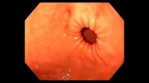 Взгляд изнутри  Как происходит процесс пищеварения