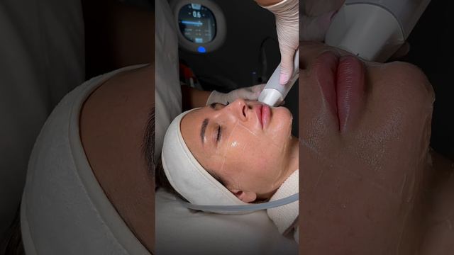 СМАС лифтинг на аппарате Ultraformer - как проходит процедура омоложения лица? | сеть клиник GEN87 смотреть онлайн