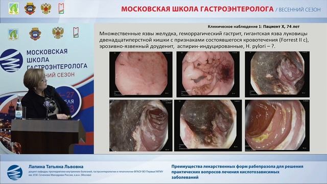 Лапина Т. Л. Преимущества лекарственных форм рабепразола для решения практических вопросов смотреть онлайн