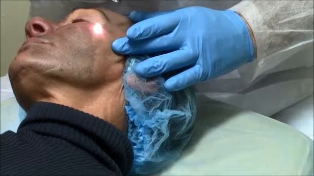 Клиника Облик Карбоновый пилинг смотреть онлайн