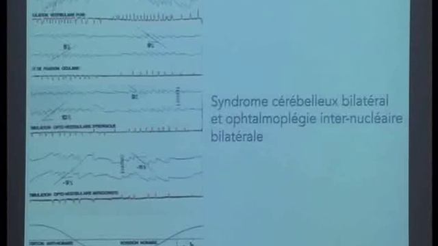 Dr Nadia AMAROUCH Vertige point de vue ORL 2 смотреть онлайн