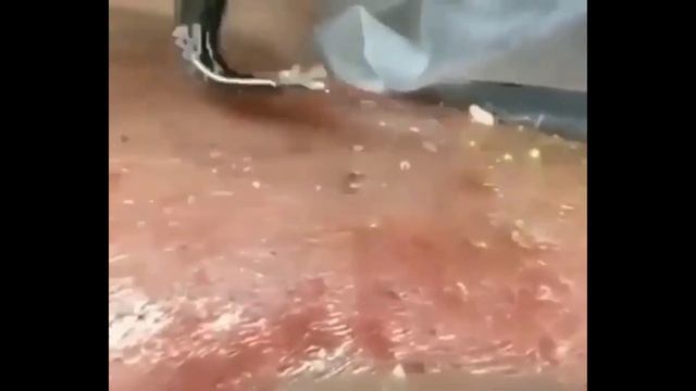 Удаление черных точек 2022 EP12 смотреть онлайн