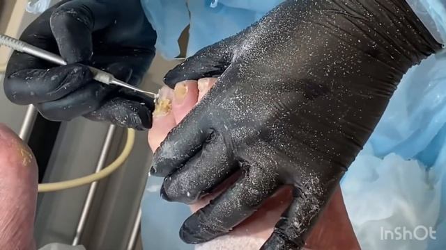 Обработка сложных ногтей смотреть онлайн