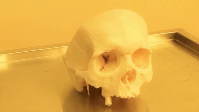 Cadaver Class In Moscow 11