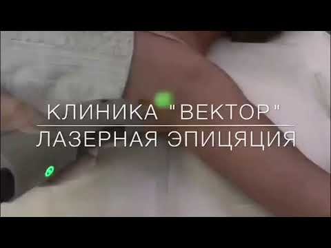 ЛАЗЕРНАЯ ЭПИЛЯЦИЯ в клинике "Вектор" смотреть онлайн
