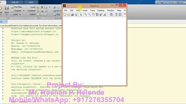Bone Fracture Detection using Matlab Project with source Code смотреть онлайн