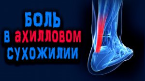 Боль в ахилловом сухожилии | профилактика травмы