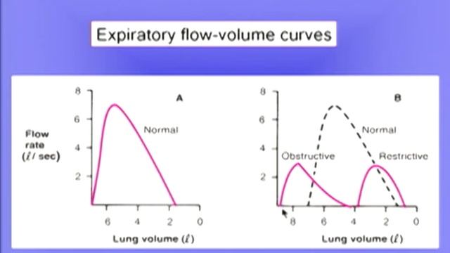 Obstructive Disease II