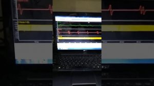 Nissan MAXIMA A32 VQ30DE 1998 года , НЕТ ОШИБОК, НЕТ ИСКРЫ ВО ВСЕХ ЦИЛИНДРАХ,  ОСЦИЛЛОГРАФФ СИЛА :)